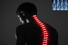 Omurga Kırığı ve Yaşlılarda Bel Ağrısı: Nedenleri, Belirtileri ve Tedavi Yöntemleri