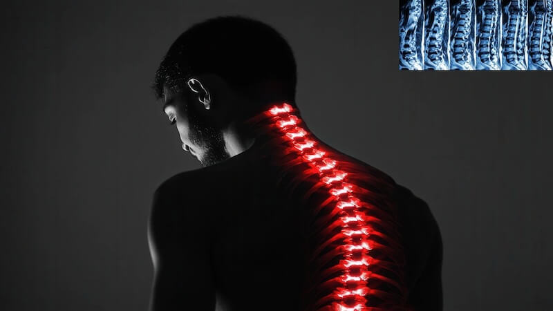 Omurga Kırığı ve Yaşlılarda Bel Ağrısı: Nedenleri, Belirtileri ve Tedavi Yöntemleri